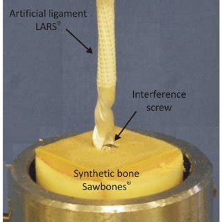 interference.screw torsional testing|The biomechanics of biodegradable versus titanium .